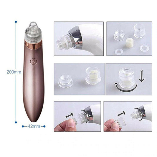 Aspirateur électrique pour points noirs et pores, élimine l'acné et les boutons, outil d'aspiration puissant, élimine les points noirs et les pores, dermabrasion au diamant, nettoyant pour le visage